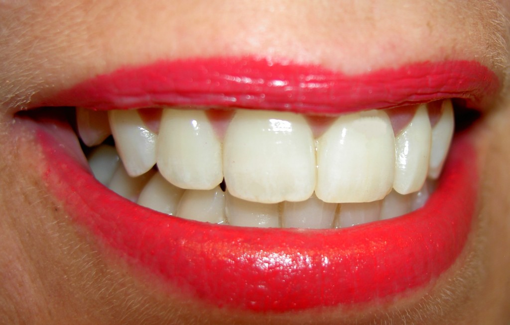 Foto de una sonrisa y dientes blancos 