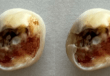 MICRO-cuentos bacterianos!