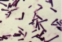 Reaparición de Clostridium tetani tras la DANA.