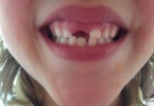 Dia Mundial de la Salud Bucodental