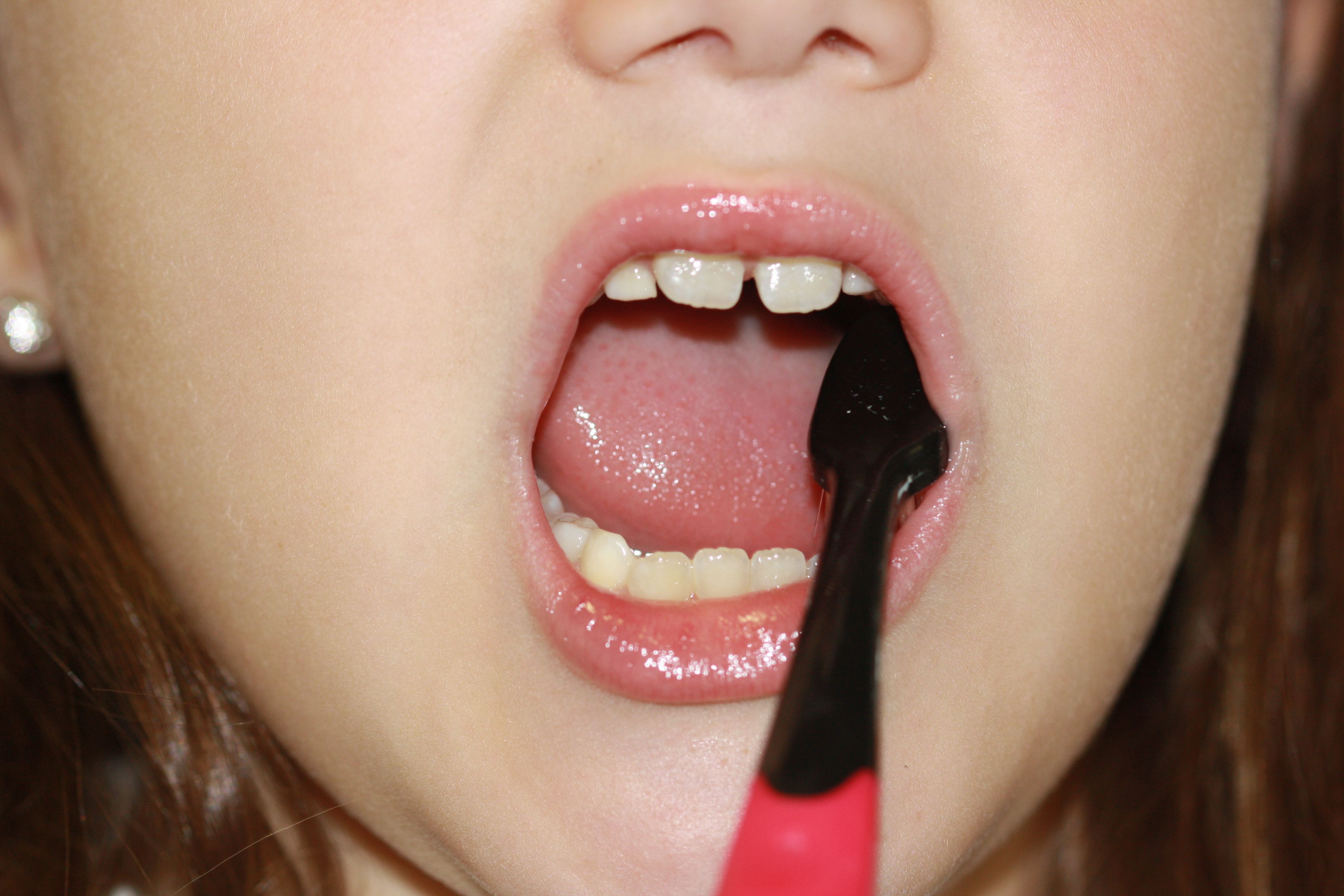 Se muestra boca de un niño cepillando los dientes