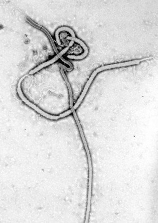 blog-ebola-deteccion-fluido-oral