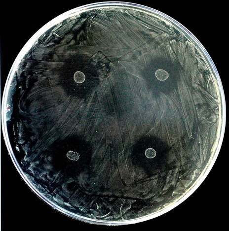 Streptococcus dentisani