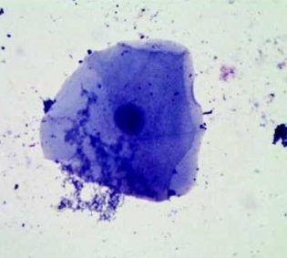 Cheek epithelial cell. From: www.youtube.com