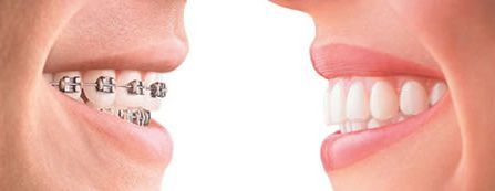 Orthodontic treatments and their results