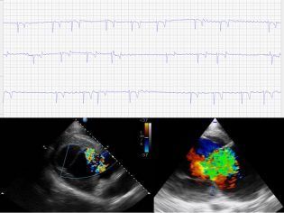 Servicio de electrocardiograma y ecocardiografía para patologías cardíacas.