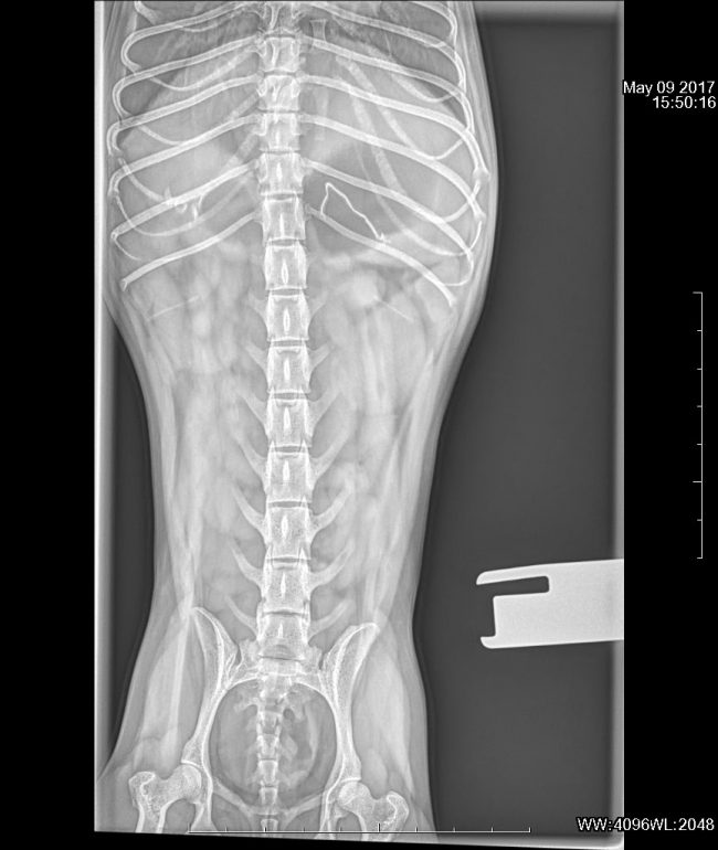 Radiografía abdominal de Meliade