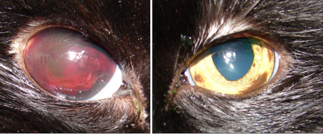 Hemorragia ocular por hipertensión secundaria a una ERC